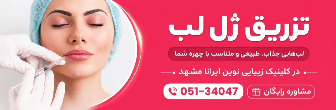 تزریق ژل لب در کلینیک نوین ایرانا